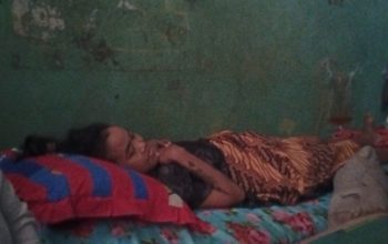Diduga Jadi Korban Malpraktik, Warga Bekasi Alami Lumpuh Total Usai Operasi Caesar
